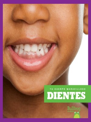 cover image of Dientes (Teeth)